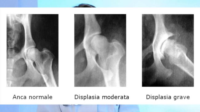 displasia anca cane corso